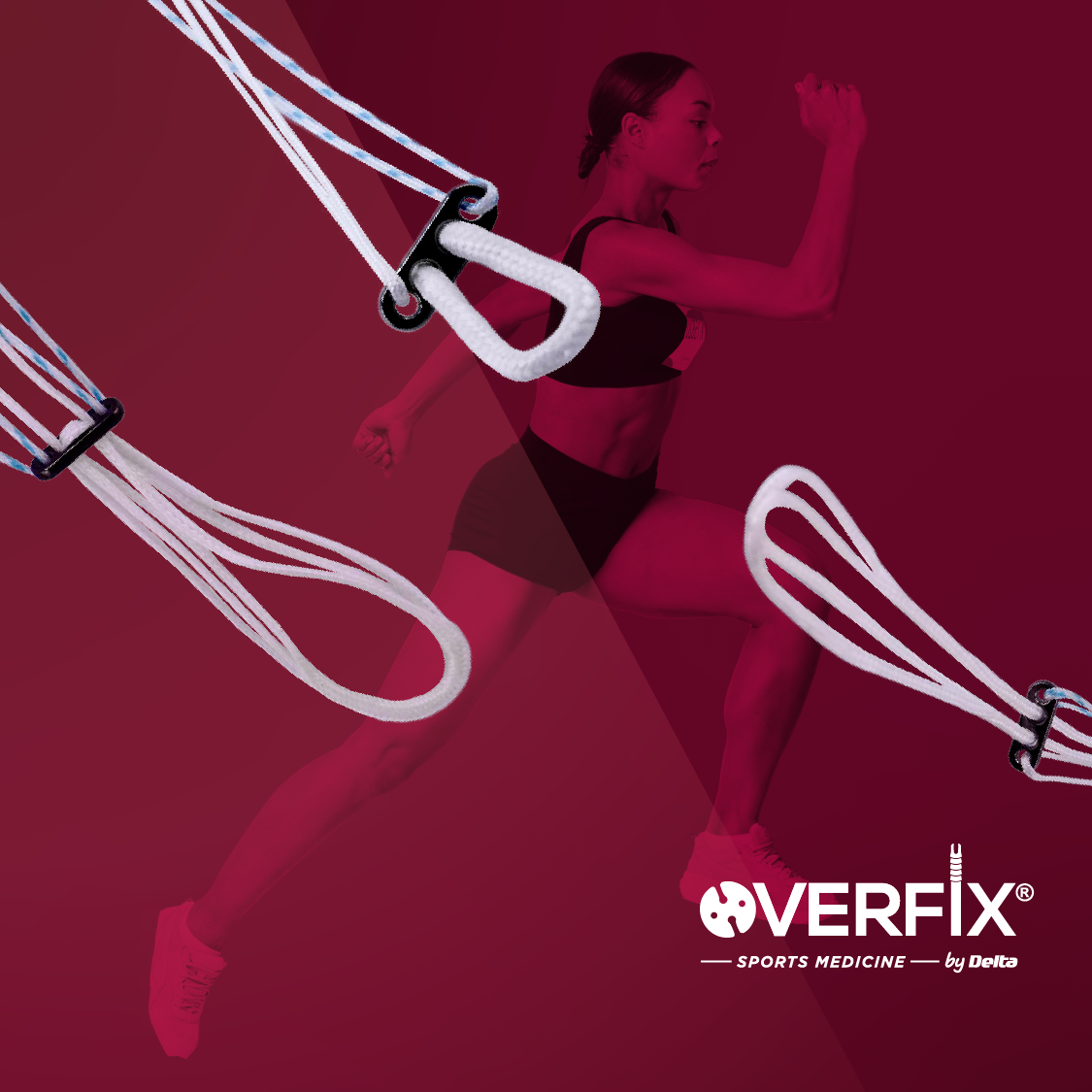 Botones de aleación