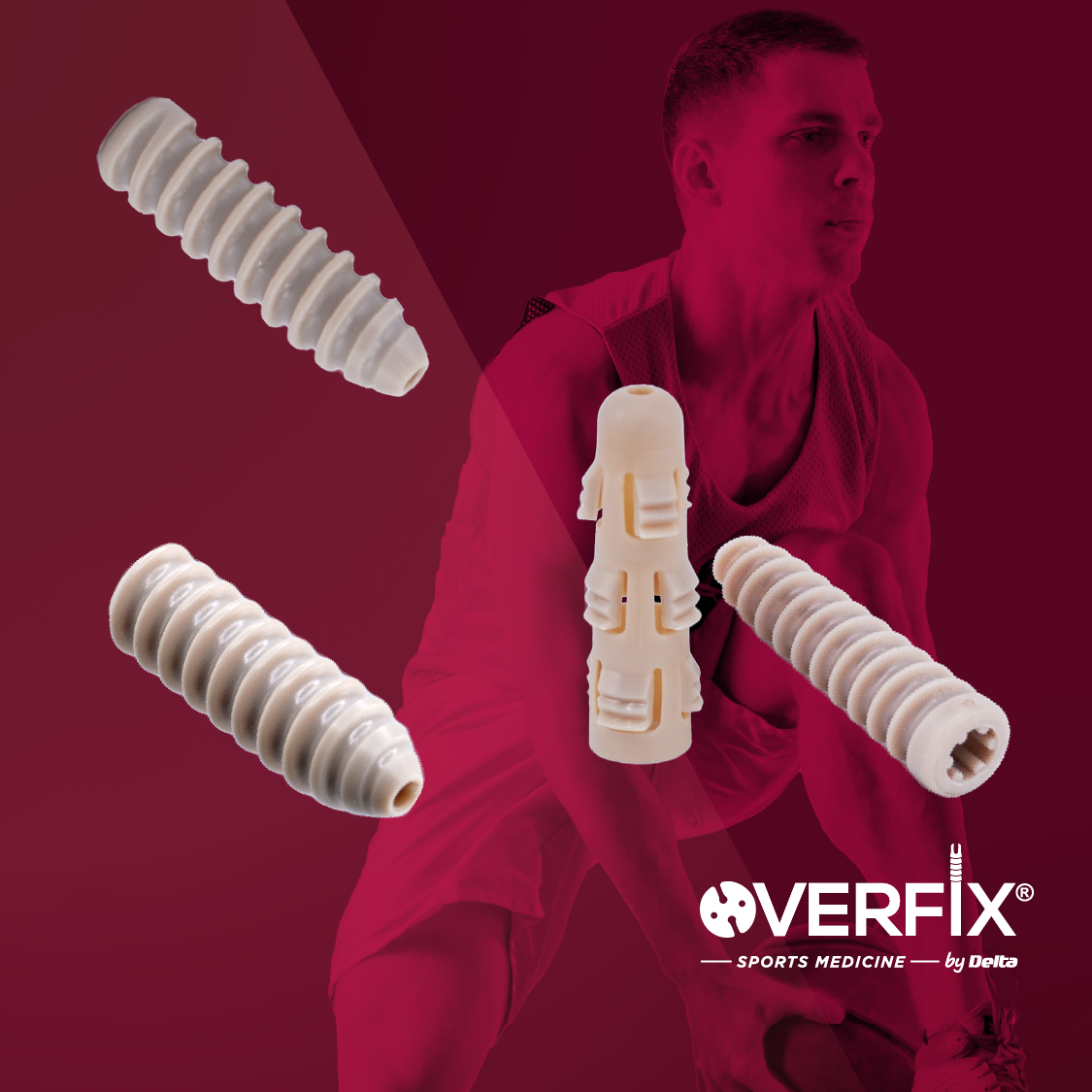 Tornillos interferenciales